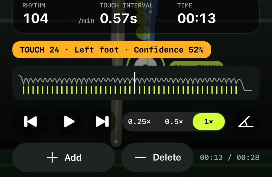 Close-up of the TouchTally replay: rhythm, touch interval and time, a touch chip with confidence, the timeline, the playback row with speed options and the angle icon, and Add and Delete buttons